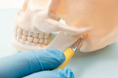 Bucomaxilofacial