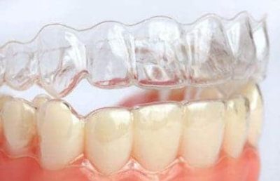 Aparelho dental Invisalign em Santo Amaro